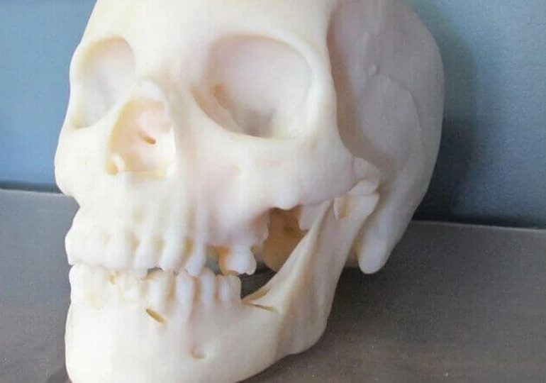 Druk 3D użyty do odtworzenia czaszki ofiary morderstwa