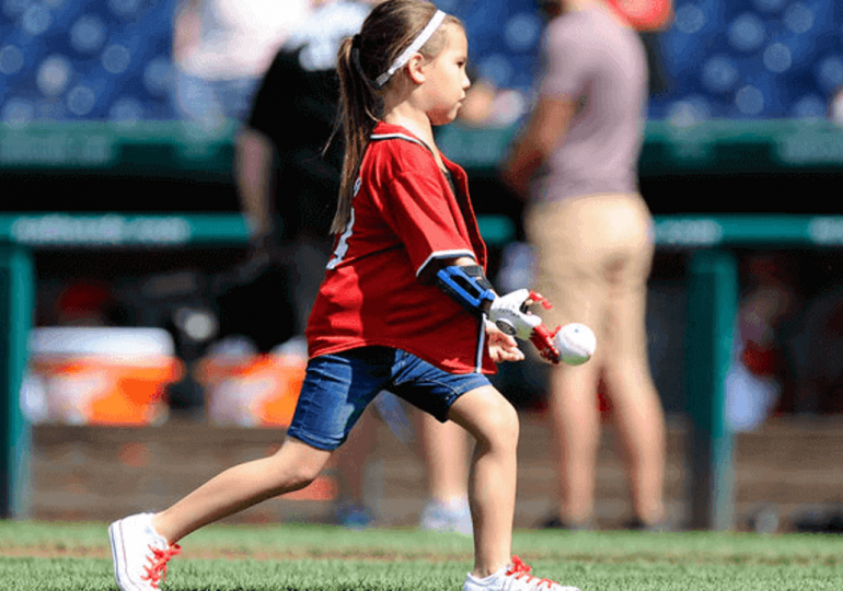Dziewczyna z wydrukowaną w 3D dłonią, dąży do rzucenia pierwszego boiska dla wszystkich 30 drużyn MLB