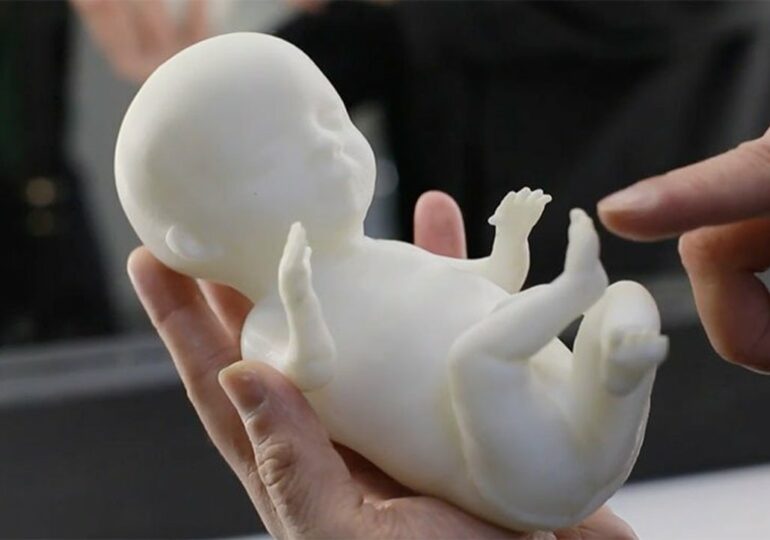 Ultrasonografia drukowana w 3D: Uzyskaj wydrukowany w 3D model swojego nienarodzonego dziecka!