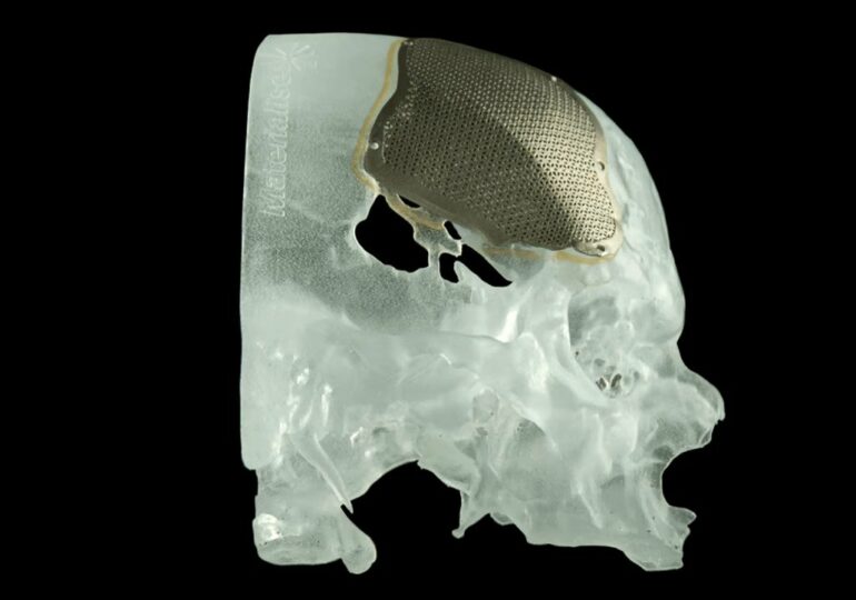 Rewolucja w chirurgii rekonstrukcyjnej twarzy dzięki drukowi 3D